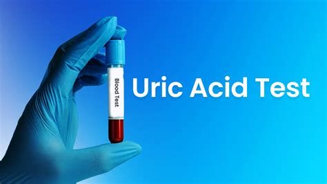 uric acid blood test bottle colour|how to prepare for uric acid testing.